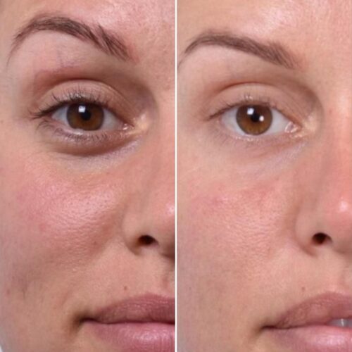 LUNÉRO PRO photo review