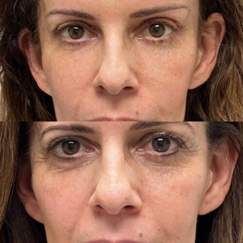 LUNÉRO PRO photo review